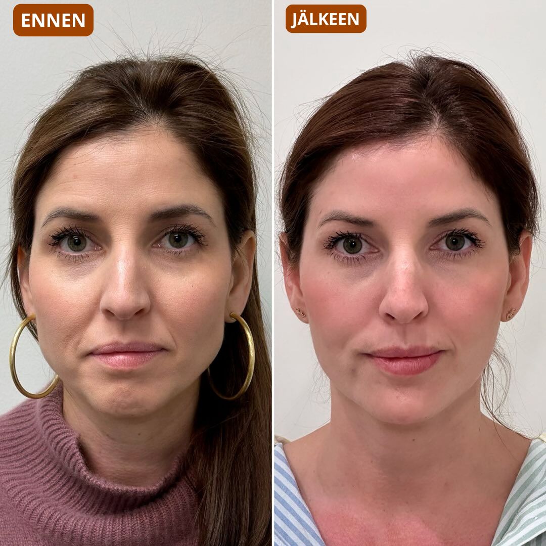 Gesichtsbürste – modelliert das Gesicht und verleiht der Haut Strahlkraft