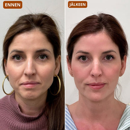 Gesichtsbürste – modelliert das Gesicht und verleiht der Haut Strahlkraft