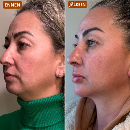 Gesichtsbürste – modelliert das Gesicht und verleiht der Haut Strahlkraft
