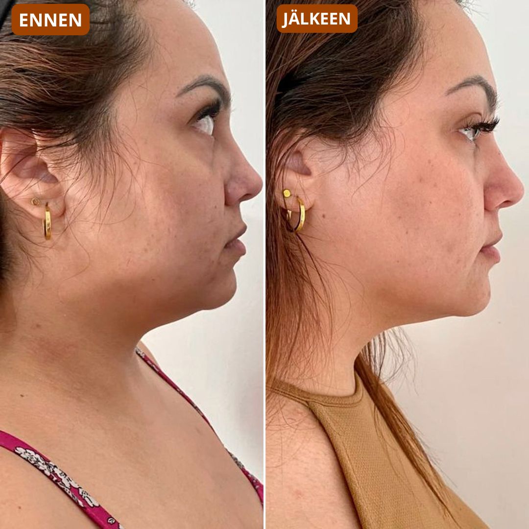 Gesichtsbürste – modelliert das Gesicht und verleiht der Haut Strahlkraft