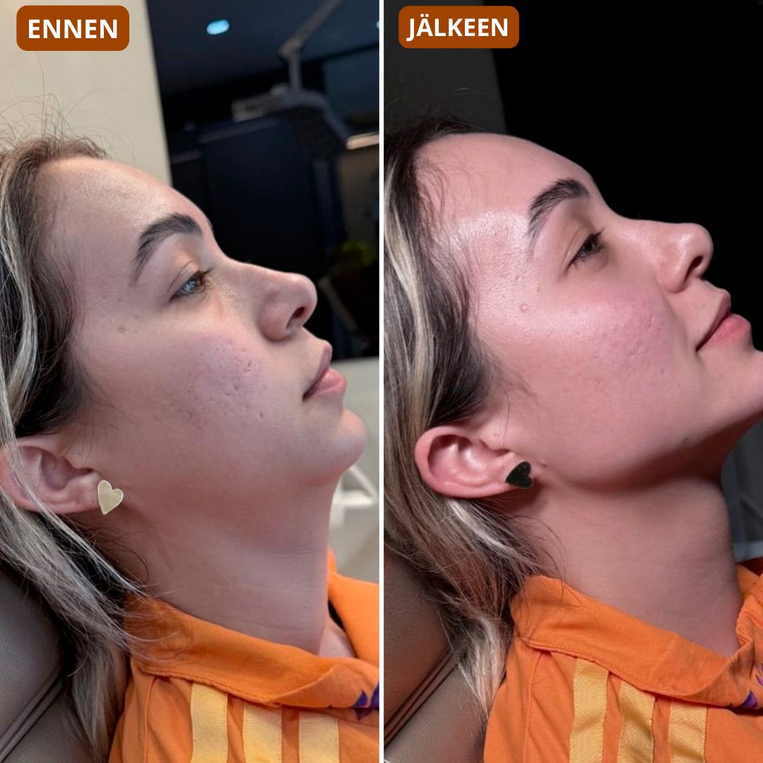Gesichtsbürste – modelliert das Gesicht und verleiht der Haut Strahlkraft