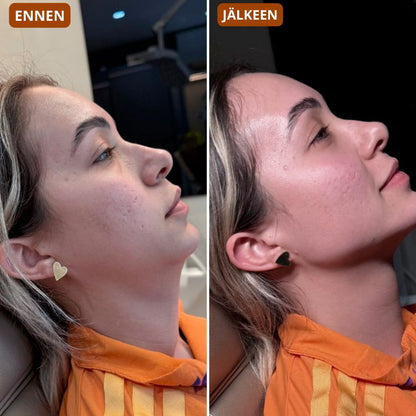 Gesichtsbürste – modelliert das Gesicht und verleiht der Haut Strahlkraft